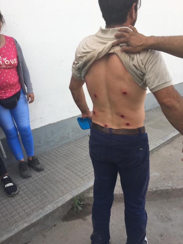 Repudiamos la represión a lxs trabajadorxs de UATRE Tucumán
